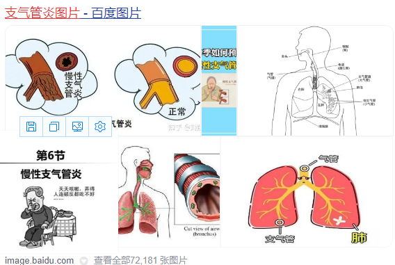 怎么样治疗支气管炎