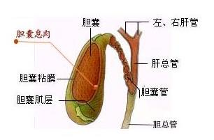 胆囊息肉怎么治疗最好？