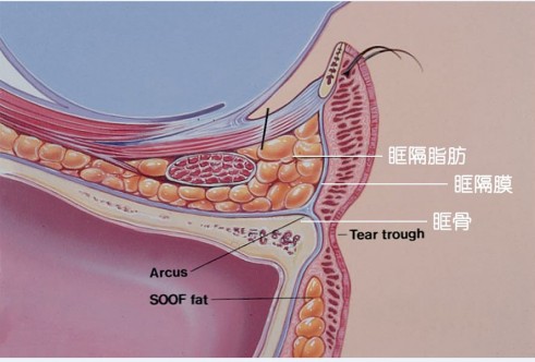 眼袋是怎么形成的？