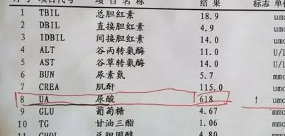 如何降低尿酸？