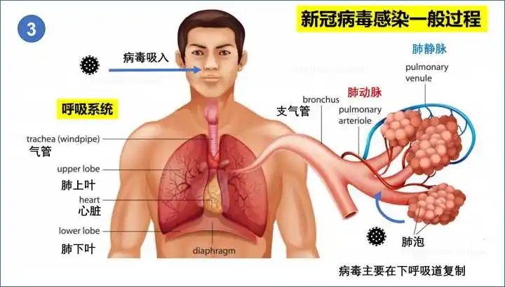 得新冠有什么表现