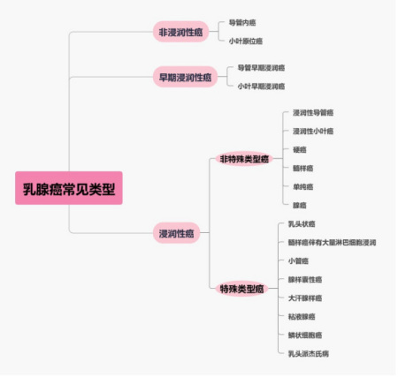 乳腺癌的类型包括哪几种