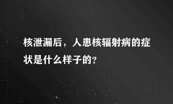 核泄漏后，人患核辐射病的症状是什么样子的？