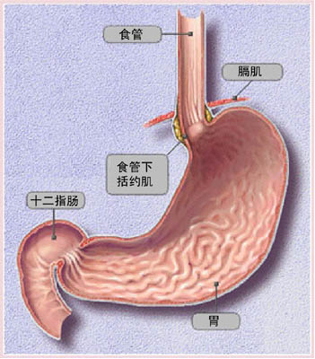 为什么会得反流性食管炎，怎样才能很好的治疗？