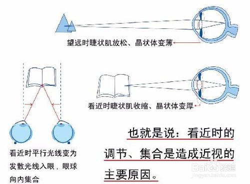 眼睛怎样会近视？