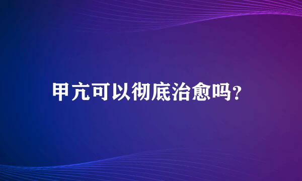 甲亢可以彻底治愈吗？