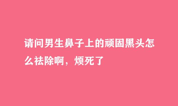 请问男生鼻子上的顽固黑头怎么祛除啊，烦死了