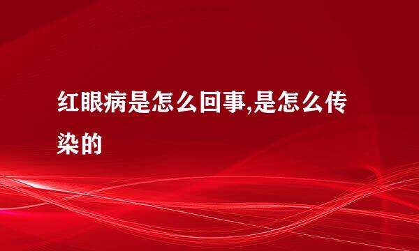 红眼病是怎么回事,是怎么传染的