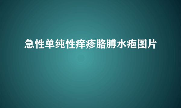 急性单纯性痒疹胳膊水疱图片