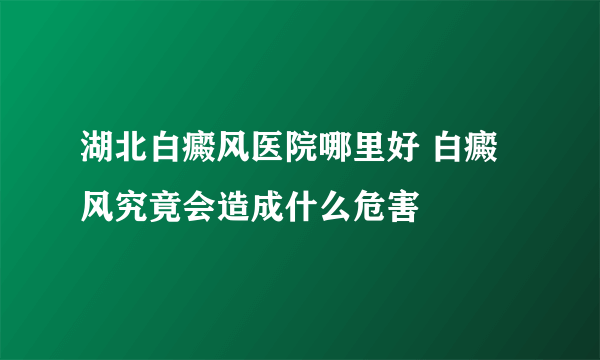 湖北白癜风医院哪里好 白癜风究竟会造成什么危害