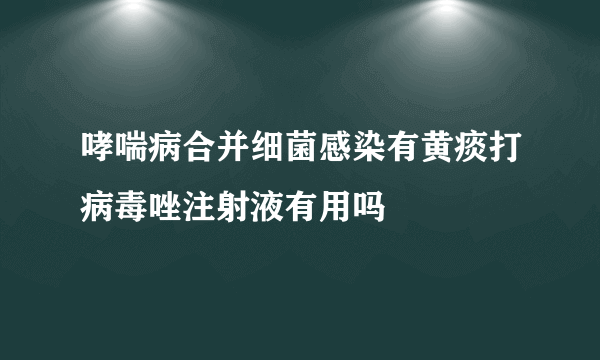 哮喘病合并细菌感染有黄痰打病毒唑注射液有用吗