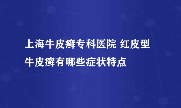 上海牛皮癣专科医院 红皮型牛皮癣有哪些症状特点