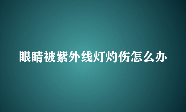 眼睛被紫外线灯灼伤怎么办