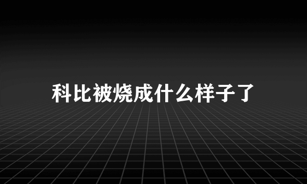 科比被烧成什么样子了