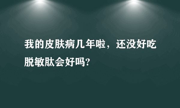 我的皮肤病几年啦，还没好吃脱敏肽会好吗?