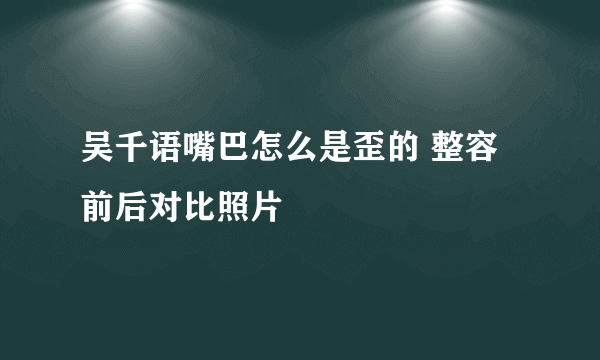 吴千语嘴巴怎么是歪的 整容前后对比照片