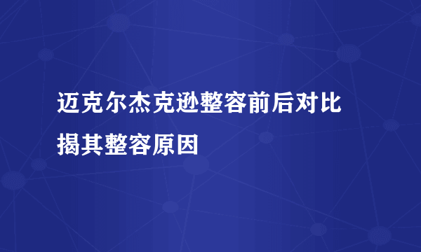 迈克尔杰克逊整容前后对比 揭其整容原因