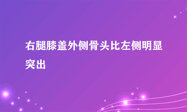 右腿膝盖外侧骨头比左侧明显突出